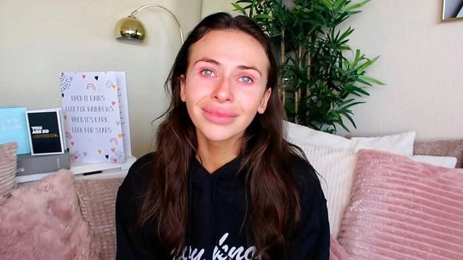 Vlogger bóc trần cơn ác mộng đằng sau sự nổi tiếng trên mạng xã hội-1