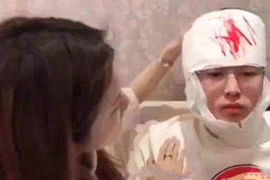 Chui vào hộp quà để tạo bất ngờ cho bạn gái, chàng trai phải khâu 20 mũi vì... người yêu dùng dao mở quà