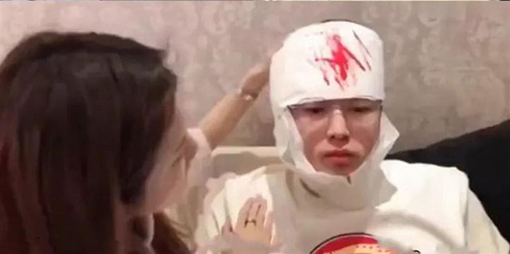 Chui vào hộp quà để tạo bất ngờ cho bạn gái, chàng trai phải khâu 20 mũi vì... người yêu dùng dao mở quà-2