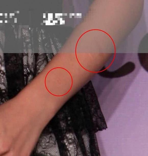 Dương Mịch lộ những vết sẹo trên cánh tay, dấy lên nghi vấn dùng dao cứa ngược đãi bản thân-4