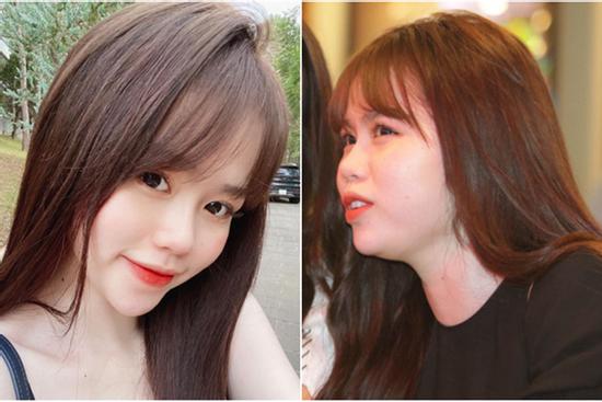 Bị soi nọng cằm, chi hơn 100 triệu làm răng vẫn xấu, bạn gái mới Quang Hải phản ứng dễ thương