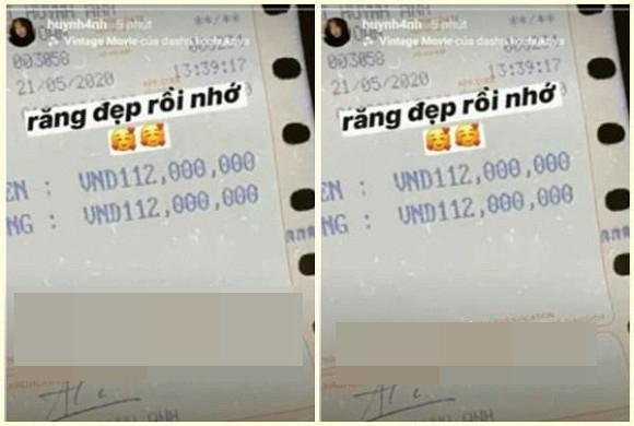 Bị soi nọng cằm, chi hơn 100 triệu làm răng vẫn xấu, bạn gái mới Quang Hải phản ứng dễ thương-4