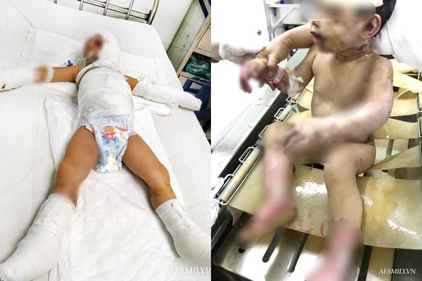 Hà Nội: Chổi lau nhà rơi từ tầng 5 chung cư cao cấp khiến bé trai vỡ đầu phải nhập viện-5