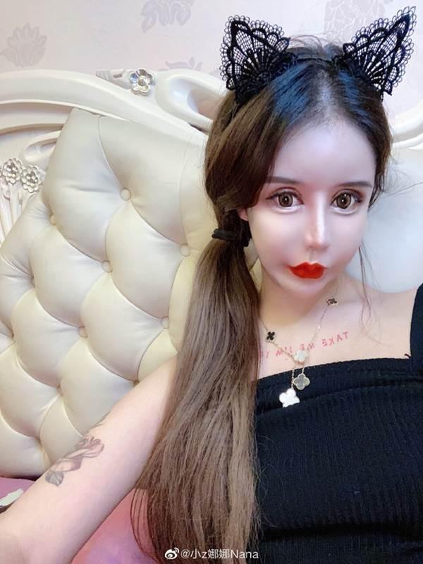 Phát hoảng trước gương mặt như búp bê hỏng vì phẫu thuật thẩm mỹ của cô gái Trung Quốc-7