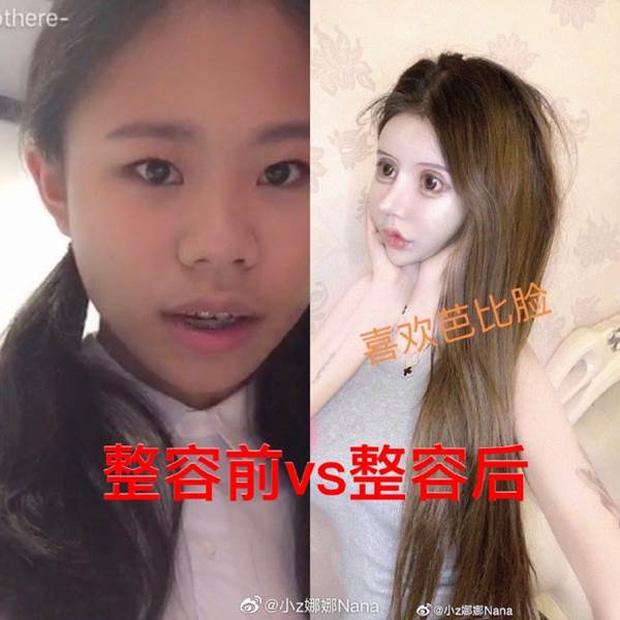 Phát hoảng trước gương mặt như búp bê hỏng vì phẫu thuật thẩm mỹ của cô gái Trung Quốc-3