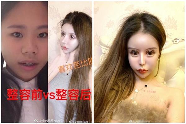 Bị người yêu cũ chê là bãi phân trâu, cô gái quyết phẫu thuật thẩm mỹ xinh như hot girl-10