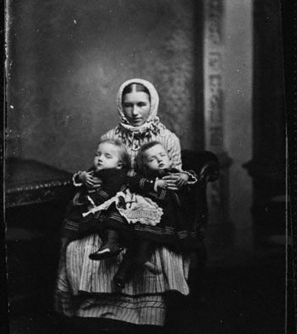 Cặp chị em song sinh dính liền đầu tiên trong lịch sử sinh con, gây thị phi vì quan hệ-1