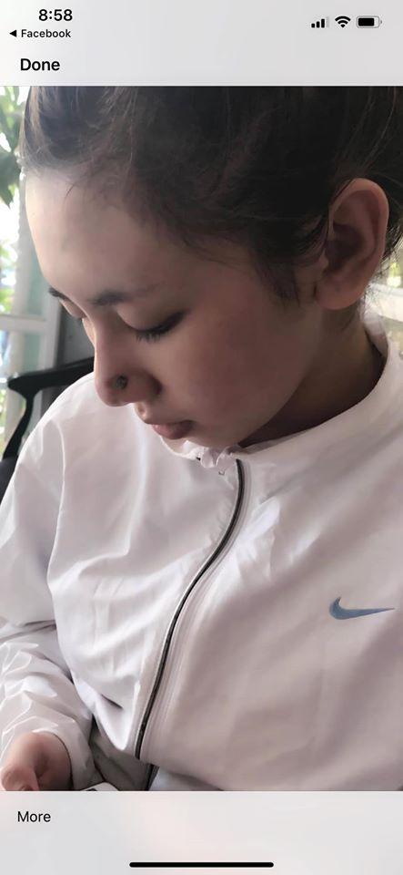 Bị người yêu cũ chê là bãi phân trâu, cô gái quyết phẫu thuật thẩm mỹ xinh như hot girl-5