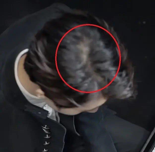 Gương mặt khác lạ của Vương Tuấn Khải: Là do lạm dụng photoshop hay tăng cân mất kiểm soát?-7