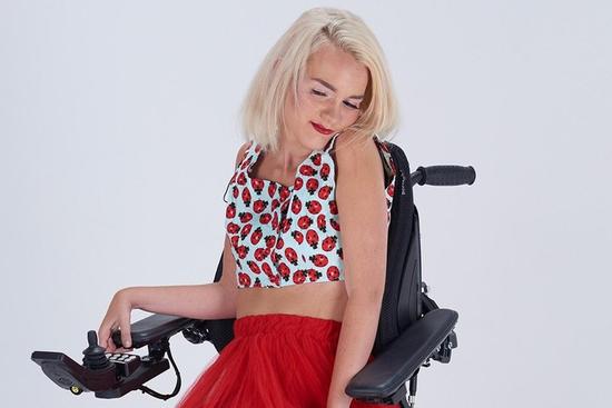 Cô gái bại não vẫn quyết tâm làm người mẫu