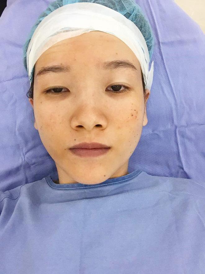 Cuộc sống thay đổi chóng mặt của cô gái mắt lươn ở Nghệ An sau 3 năm nổi đình đám MXH-2