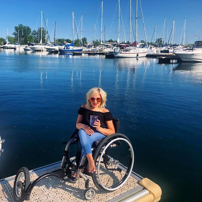 Chuyện tình đẹp 14 năm của cô gái có thể gãy xương chỉ vì hắt hơi-8