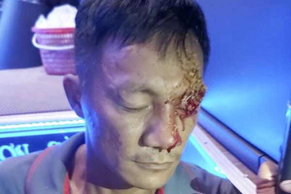 Vụ nổ súng ở bến xe Quy Nhơn: Nạn nhân kể lại giây phút kinh hoàng!-3