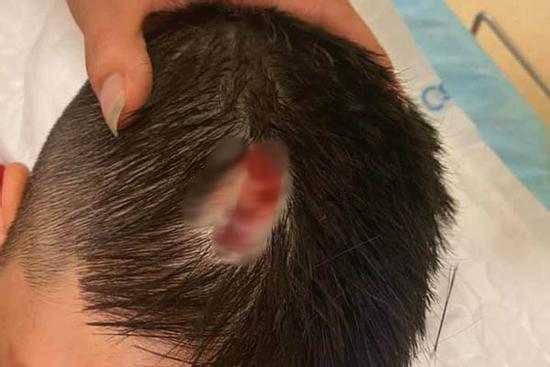 Hà Nội: Chổi lau nhà rơi từ tầng 5 chung cư cao cấp khiến bé trai vỡ đầu phải nhập viện