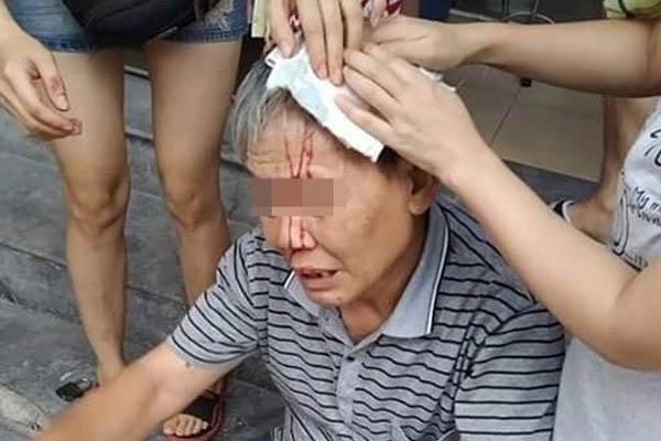 Người Hà Nội chết khiếp vì đồ vật bất thình lình bay từ chung cư xuống vỡ đầu-2