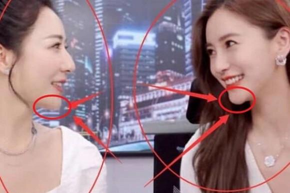 Cứ khăng khăng không thẩm mỹ, Angelababy vẫn bị soi chiếc cằm dị thường-4