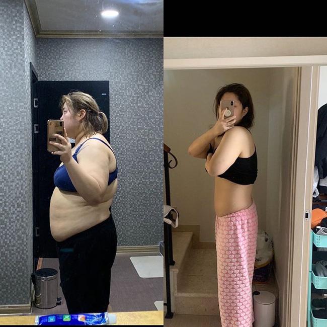 Thánh ăn Hàn Quốc Yang Soobin mắc ung thư tuyến giáp sau nỗ lực giảm 33kg-2