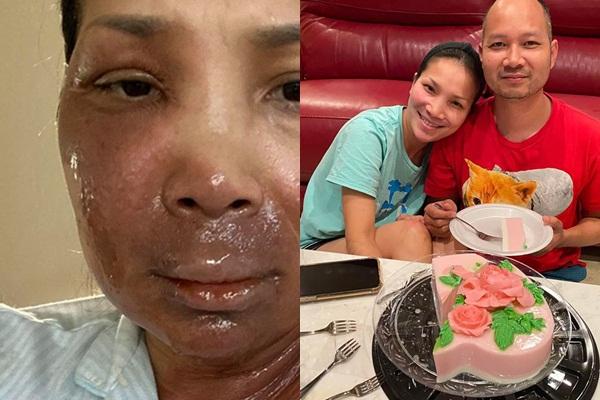 Hồng Ngọc đẹp rạng ngời sau sự cố bỏng nặng, sẵn sàng trở lại sân khấu-4