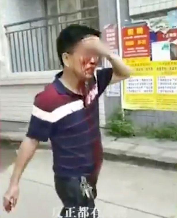 Bảo vệ trường học Trung Quốc bất ngờ dùng dao tấn công điên cuồng khiến 40 người bị thương-3