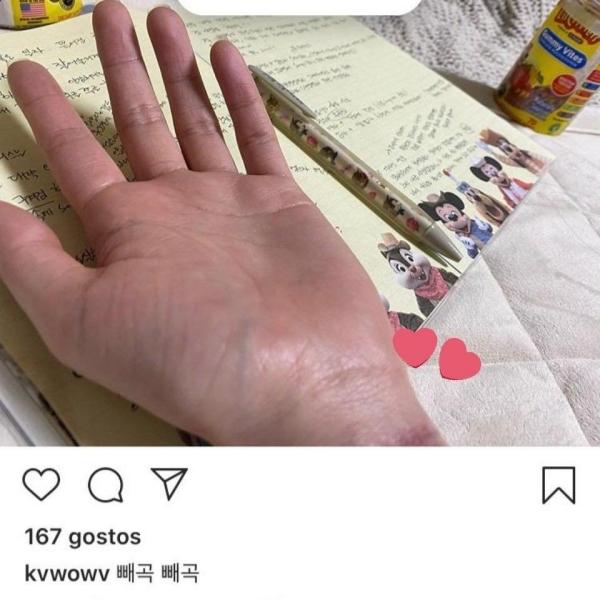 Cựu thành viên AOA cắt cổ tay, có dấu hiệu bất thường về tinh thần?-1