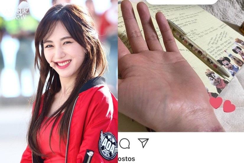 Nữ thần tượng AOA cắt cổ tay tự tử vì bị thành viên cùng nhóm bắt nạt-6