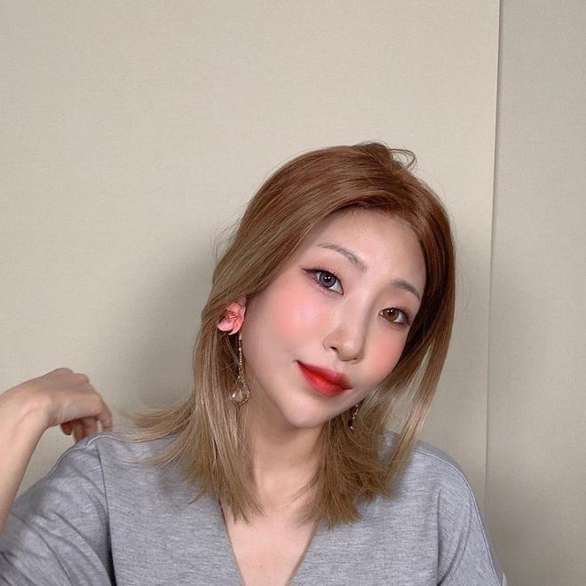 Diễn viên Reply 1988 tiêm botox, giảm 36 kg để trông xinh hơn-2