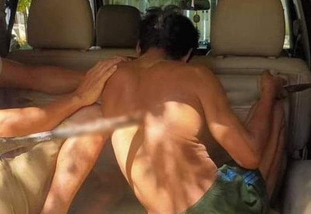 Người đàn ông bị chiếc xà beng hơn 1 mét đâm xuyên người-1