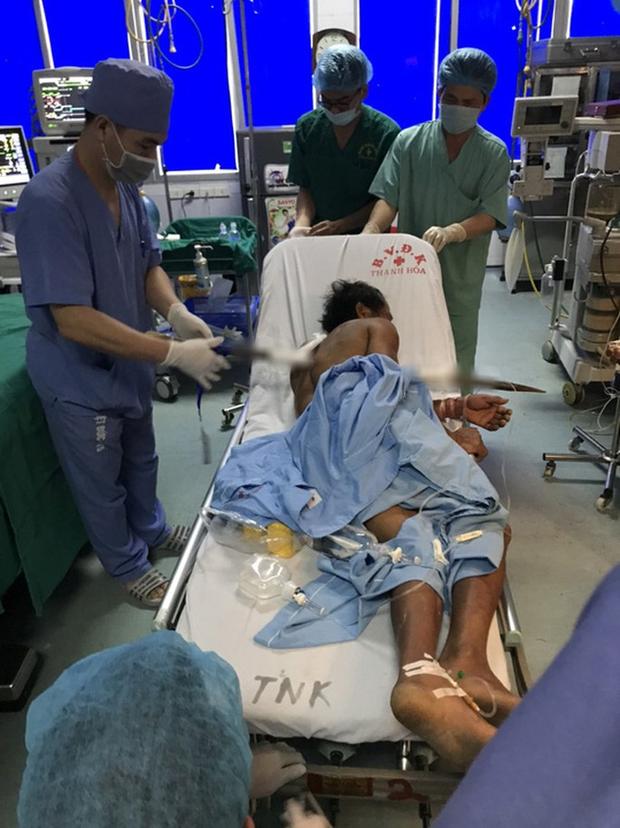 Người đàn ông bị chiếc xà beng hơn 1 mét đâm xuyên người-2