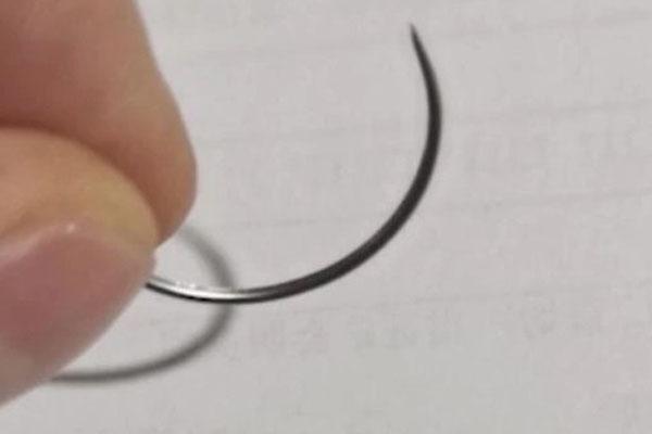 Đút dây sạc điện thoại vào dương vật, người đàn ông đau quặn ruột gan-2