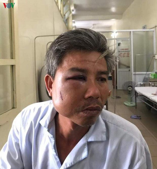 Khởi tố chủ quán cà phê đánh nhân viên cây xanh nhập viện-2