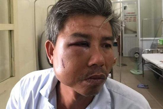 Khởi tố chủ quán cà phê đánh nhân viên cây xanh nhập viện