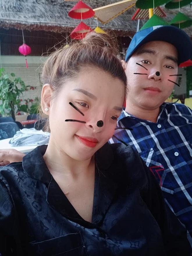 Cô gái có mặt biến dạng và chuyện tình đẹp với bạn trai kém 4 tuổi-3