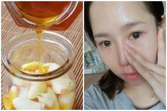Ít ai biết rằng sử dụng mật ong để thoa mặt mỗi ngày, có thể trị tàn nhang, làm trắng da và giúp da mềm mại