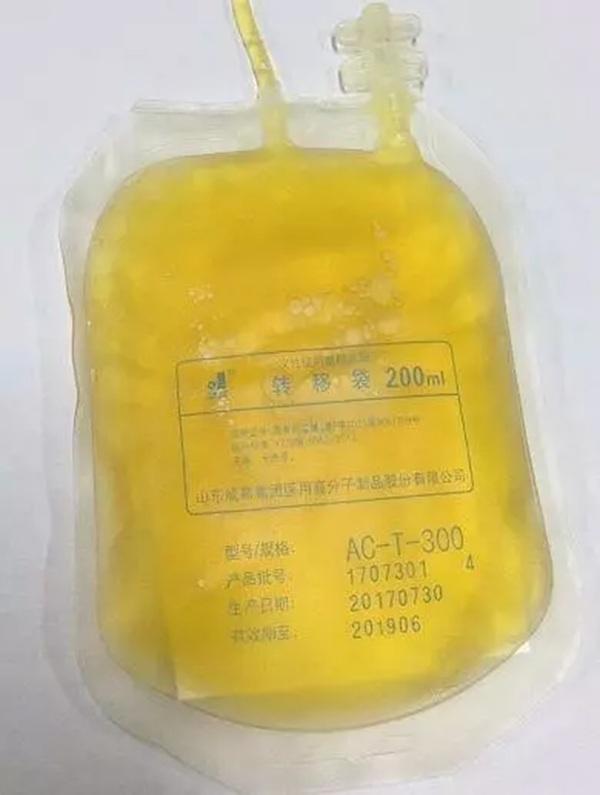 Ăn thức ăn nhanh quá nhiều, huyết tương của chàng trai trông như trà sữa-2