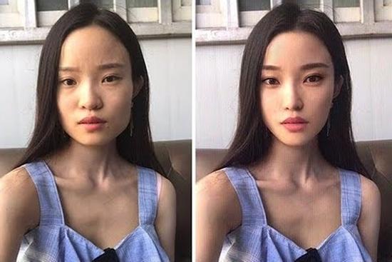 Vì sao phụ nữ Trung Quốc chi chục nghìn USD để sửa nhan sắc?