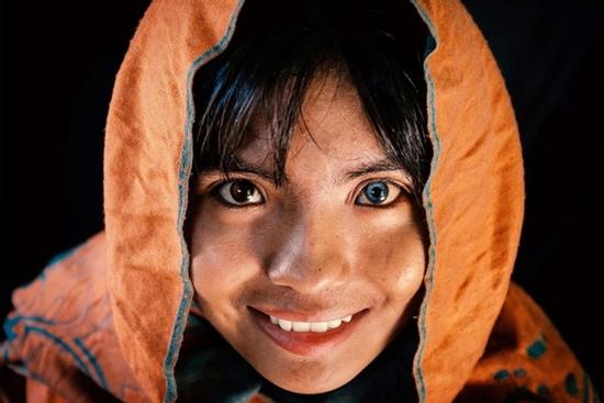 Cô gái Chăm có 2 màu mắt, là người duy nhất trong gia đình học đại học