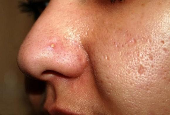 Những hành vi chết của phụ nữ làm cho lỗ chân lông ngày càng to hơn!-1