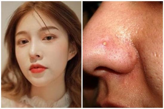 Những hành vi 'chết' của phụ nữ làm cho lỗ chân lông ngày càng to hơn!