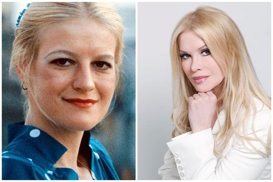 Người phụ nữ dao kéo nhiều nhất thế giới trẻ trung ở tuổi 64