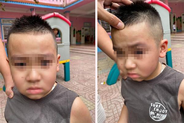 Bé mầm non đi học đánh nhau với bạn, phụ huynh đến tận trường tát sưng mặt đối thủ-2