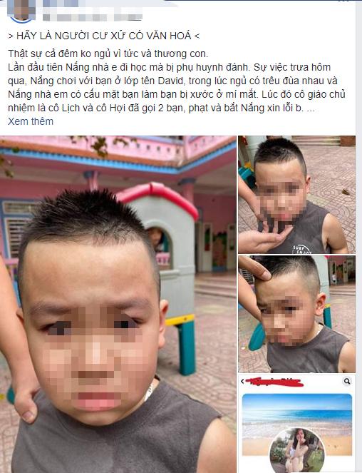 Bé mầm non đi học đánh nhau với bạn, phụ huynh đến tận trường tát sưng mặt đối thủ-1