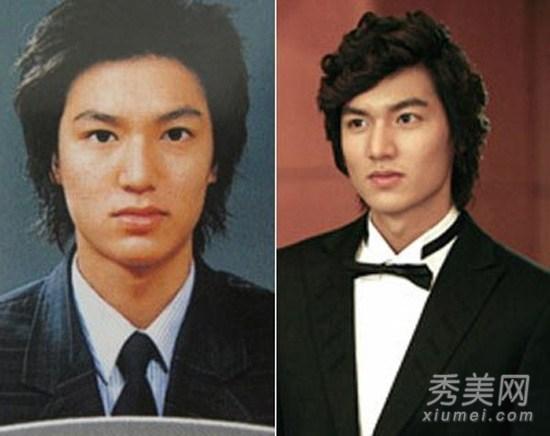 Lee Min Ho bị đào mộ loạt ảnh thời còn phèn: Mặt rỗ, gầy gò, style như Khá Bảnh-6