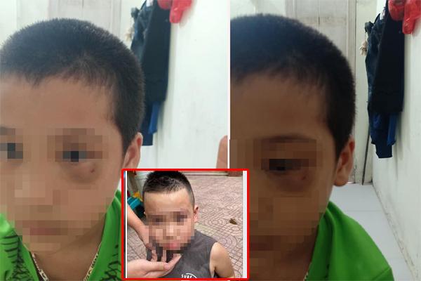 Cô giáo mầm non nói gì về việc đánh trẻ?-3