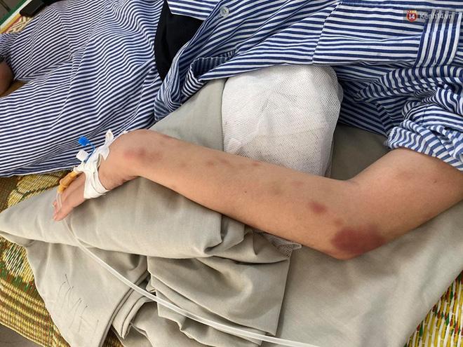 Cô gái bị tra tấn suốt 2 tiếng: Gã xăm trổ là người yêu cũ, từng đi tù 2 lần tội đánh người-5