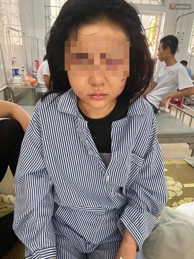 Cô gái bị tra tấn suốt 2 tiếng: Gã xăm trổ là người yêu cũ, từng đi tù 2 lần tội đánh người-4