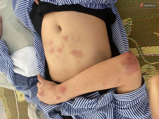 Cô gái bị tra tấn suốt 2 tiếng: Gã xăm trổ là người yêu cũ, từng đi tù 2 lần tội đánh người-6