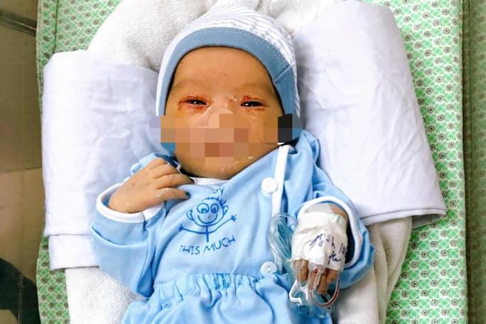 Thông tin mới nhất về tình hình sức khỏe của bé sơ sinh bị bỏ rơi 3 ngày dưới hố gas ở Hà Nội-2