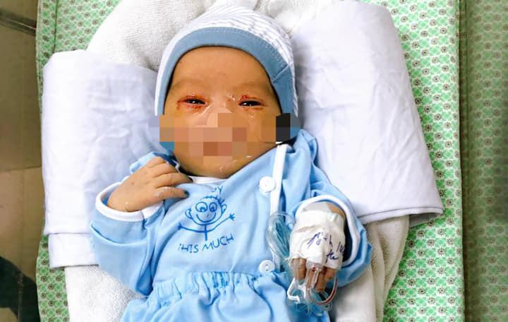 Bé trai bị bỏ rơi ở hố gas bị nhiễm trùng máu, phải thở máy-1