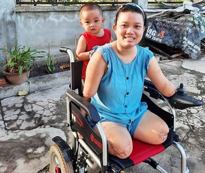 Tình yêu của chồng giúp người vợ mất tứ chi vượt qua mặc cảm-4