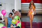 Hoa hậu Colombia 2011 phải cưa chân vì biến chứng phẫu thuật